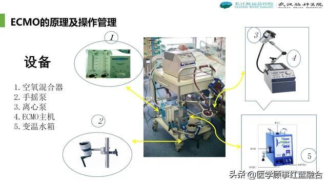 国产ECMO系统获欧盟医疗器械认证